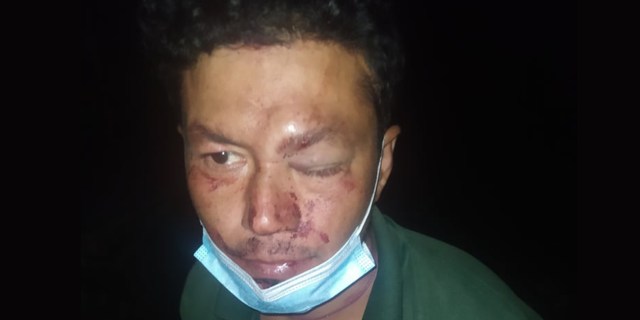 दाजुले चालकलाई कुट्ने,बहिनीले पत्रकार धम्काउँने !