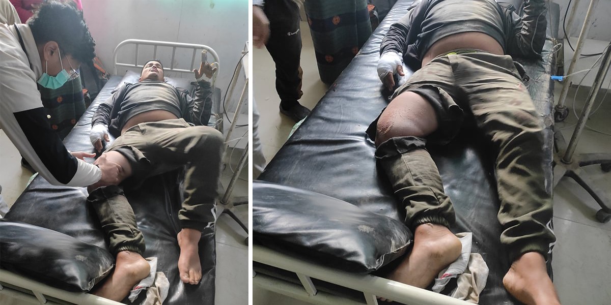 बडिगाडका एक युवक बसले किचेर गम्भीर घाईते !