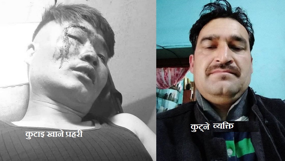 छुट्टिमा घर जाँदै गरेका प्रहरी हवल्दार कुटिए, प्रहरीबाटै उजुरी लिन अस्वीकार !