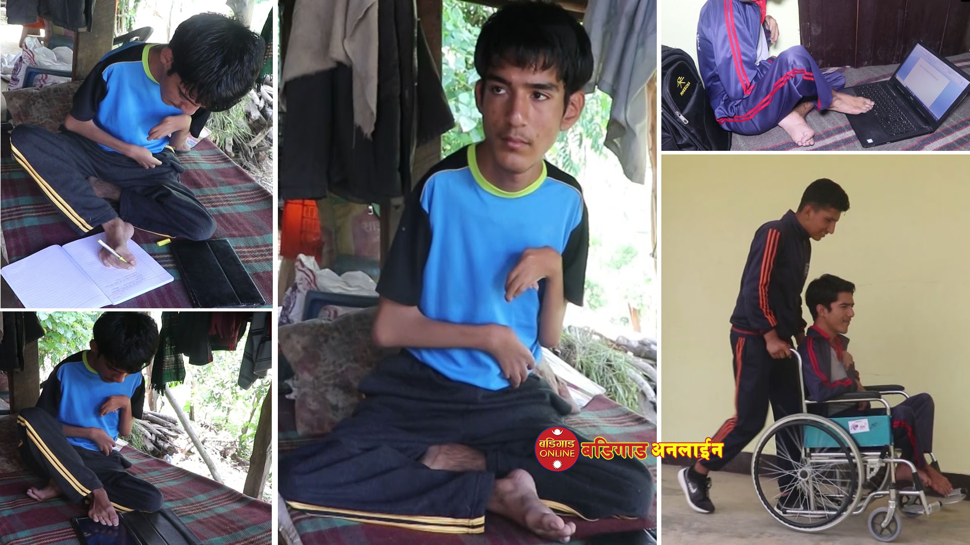 दाहिने खुट्टाका दुई औंलाबाहेक अरू चल्दैनन् तर सबै क्षेत्रमा अब्बल छन् गुल्मीका ऋषिराम