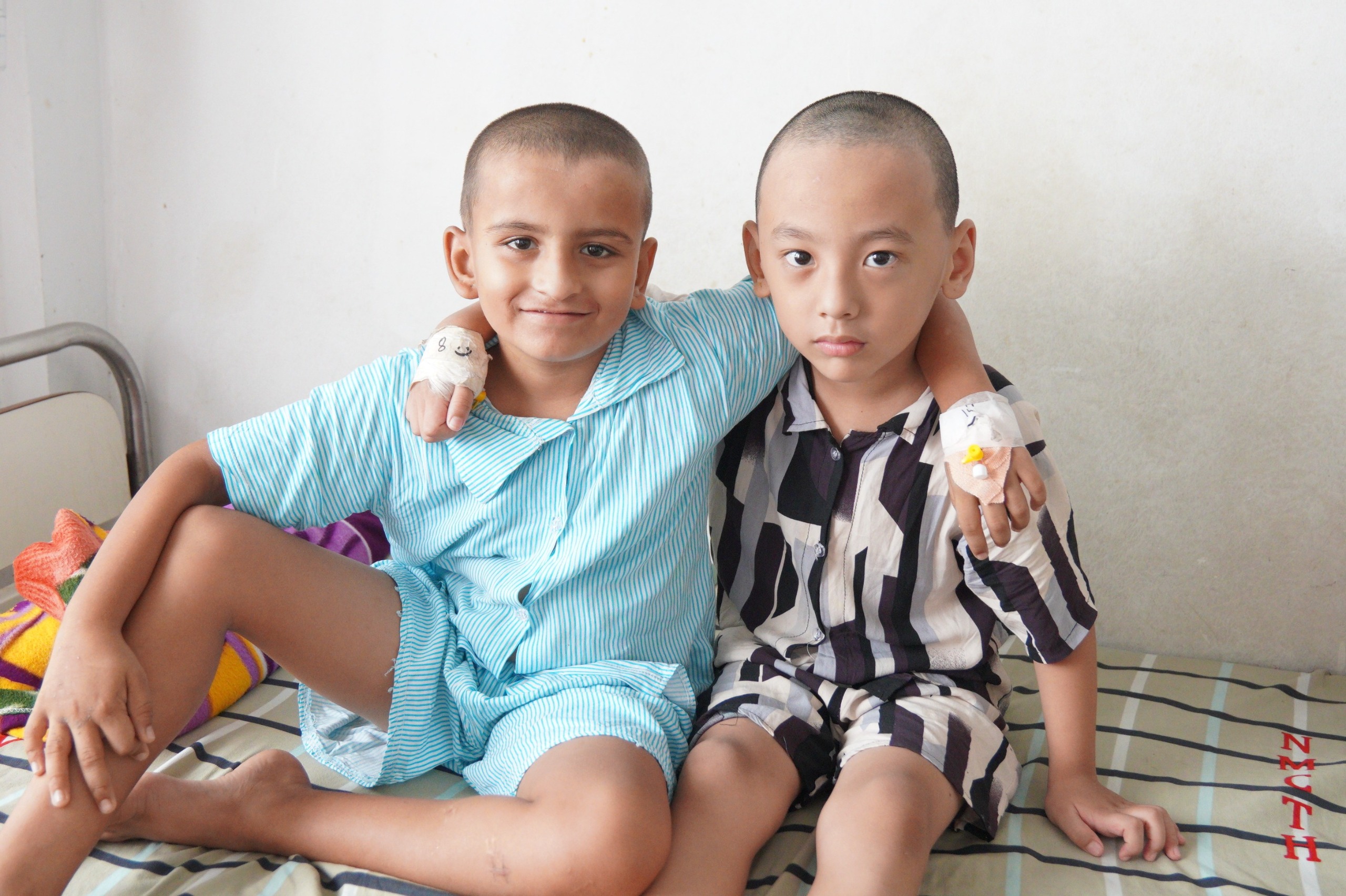 जन्मजात सुन्न र बोल्न नसक्ने दुई बालकको नोबेलमा कोक्लियर इम्प्लान्ट शल्यक्रिया