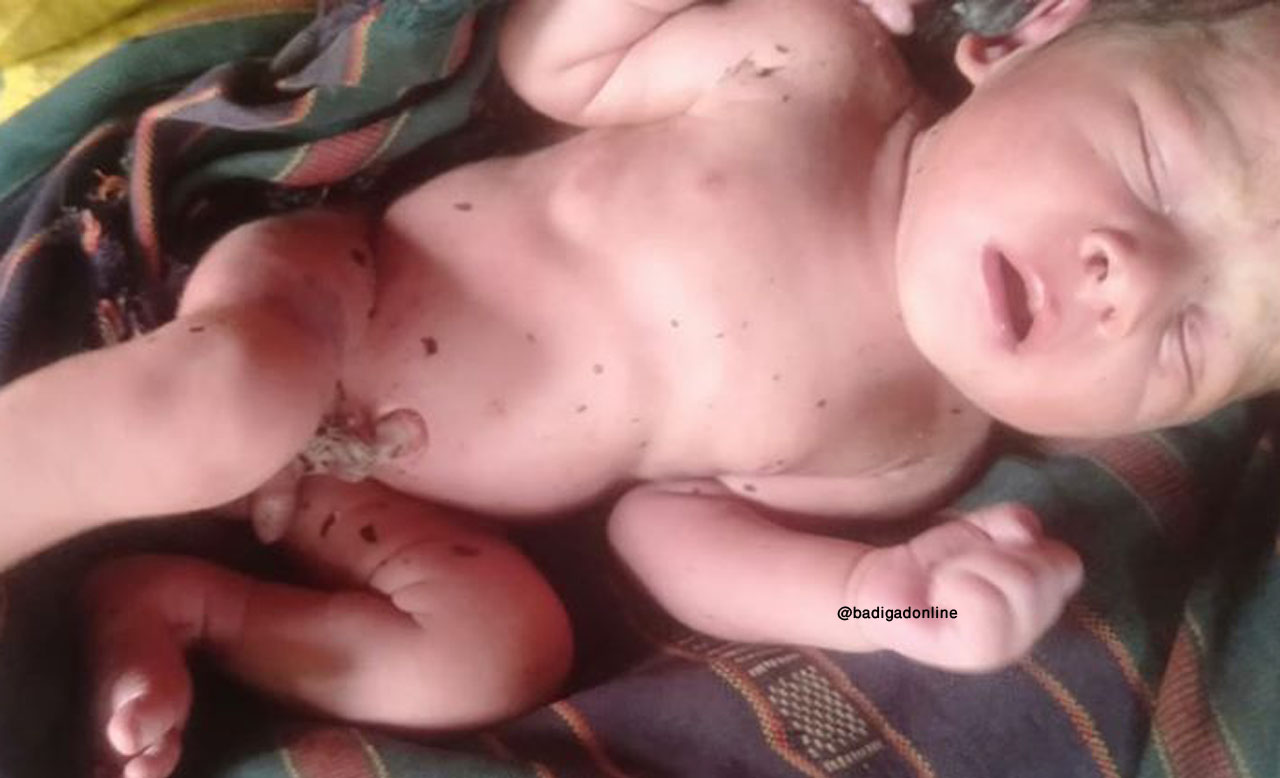 बाग्लुङको निशिखोला जंगलमा बेवारिसे नवजात शिशु फेला !