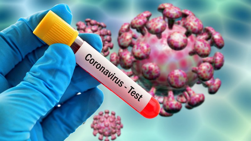 गुल्मीमा थप २ जनामा कोरोना सक्रंमण, सक्रंमितको संख्या ३ सय ८१ पुग्यो