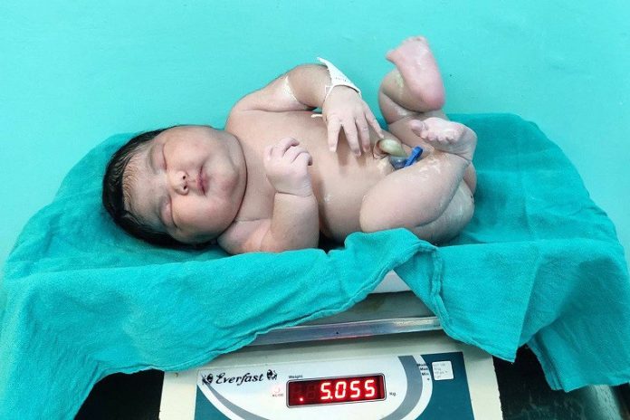 चितवन मेडिकल कलेजमा ११२ किलोकी महिलाले जन्माइन् पाँच किलोको बच्चा !