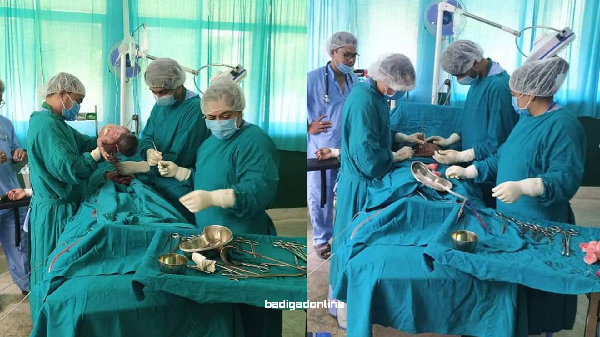 पश्चिम बागलुङबासीका लागि खुसीको खबर ! बुर्तिबाङ प्राथमिक स्वास्थ्य केन्द्रमा पुन: सुरुभयो प्रसुति शल्यक्रिया सेवा